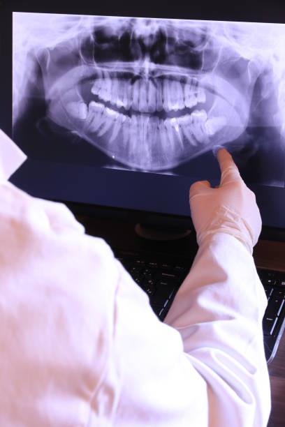 Best Emergency Gum Treatment in Sullivans Island, SC